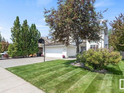 78 Nottingham Hb, Sherwood Park, AB 