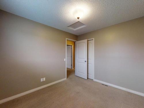 18015 87 St Nw, Edmonton, AB 