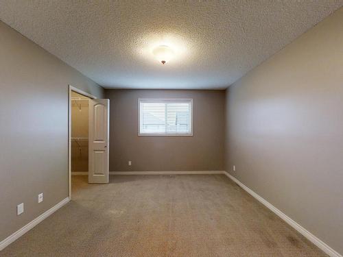 18015 87 St Nw, Edmonton, AB 