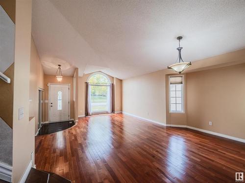 34 Arcand Drive, St. Albert, AB - Indoor Photo Showing Other Room