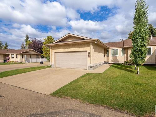 131 Knottwood Road N, Edmonton, AB - Outdoor With Facade