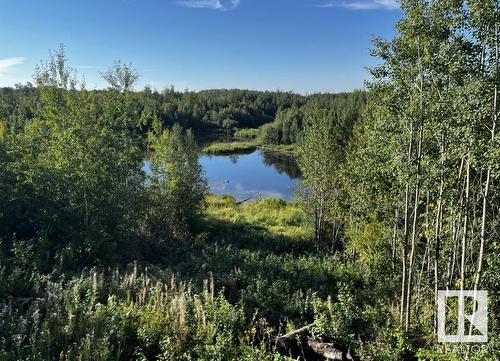 51 52210 Rr 192, Rural Beaver County, AB - Outdoor With View