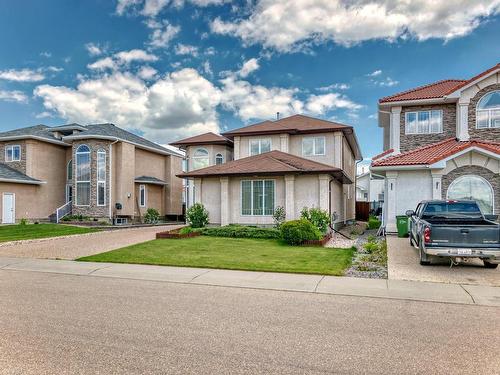 15907 91 Street, Edmonton, AB - Outdoor With Facade