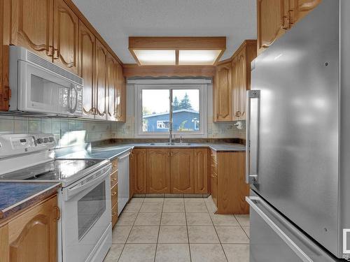 56 Woodlake Co, Sherwood Park, AB 