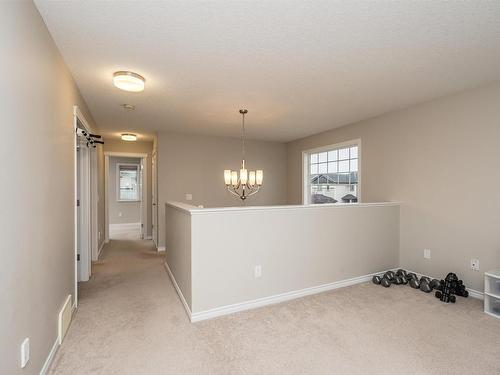 8100 Ellesmere Cv, Sherwood Park, AB 