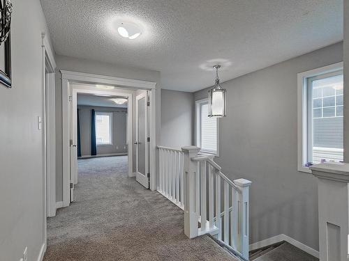 18016 78 St Nw, Edmonton, AB 