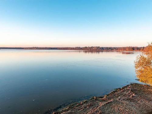 78 52343 Rge Road 211, Rural Strathcona County, AB - Outdoor With Body Of Water With View