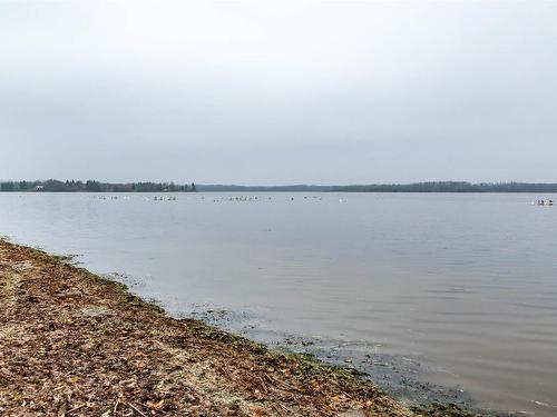 78 52343 Rge Road 211, Rural Strathcona County, AB - Outdoor With Body Of Water With View