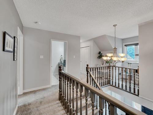 322 Vista Mr, Sherwood Park, AB 