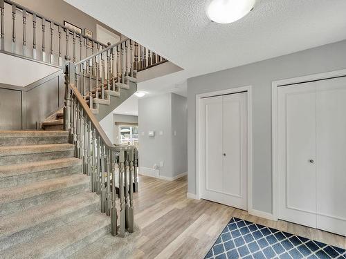 322 Vista Mr, Sherwood Park, AB 