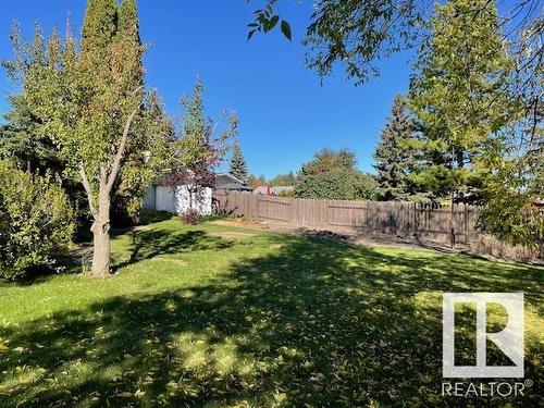 115 Galen Pl Nw, Sherwood Park, AB 