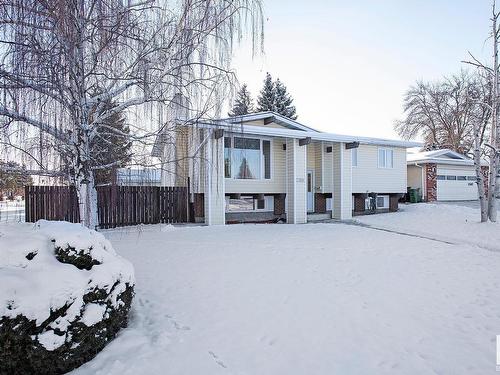 11503 159 Avenue, Edmonton, AB - Outdoor With Facade