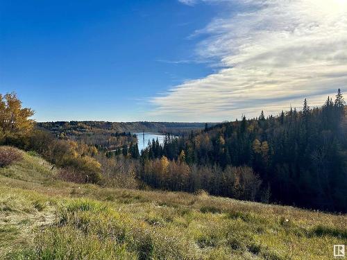 7502 155 Street, Edmonton, AB - Outdoor With View