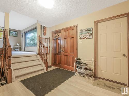 331 Vista Dr, Sherwood Park, AB 