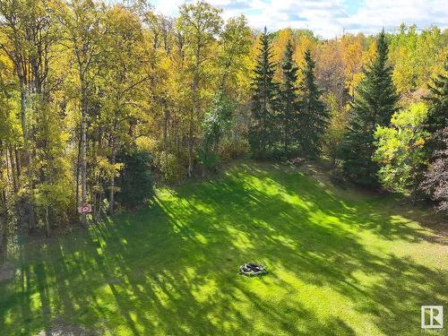 73 52152 Rge Road 225, Rural Strathcona County, AB - Outdoor With View