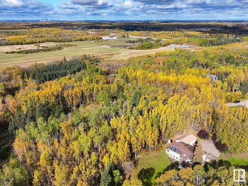 73 52152 Rge Road 225, Rural Strathcona County, AB - Outdoor With View