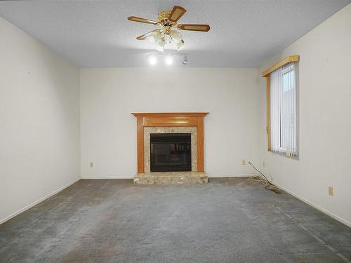 15923 129 Street, Edmonton, AB - Indoor Photo Showing Living Room With Fireplace