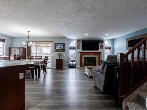 16215 48 Street, Edmonton, AB - Indoor Photo Showing Living Room With Fireplace