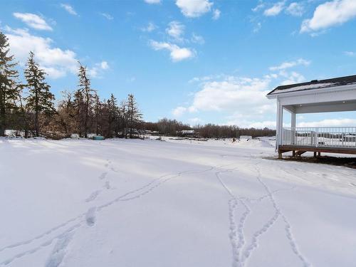 2 54104 Rge Road 274, Rural Parkland County, AB - Outdoor With View