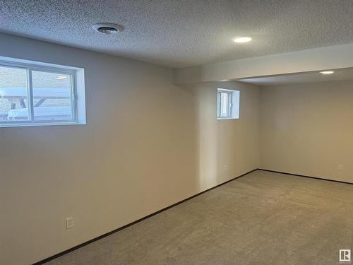 9234 179 Avenue, Edmonton, AB - Indoor Photo Showing Other Room