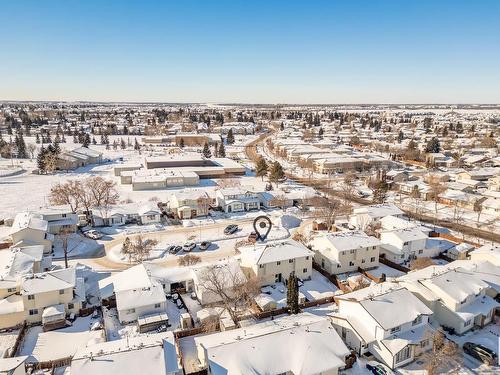 10319 172 Avenue Nw, Edmonton, AB - Outdoor With View