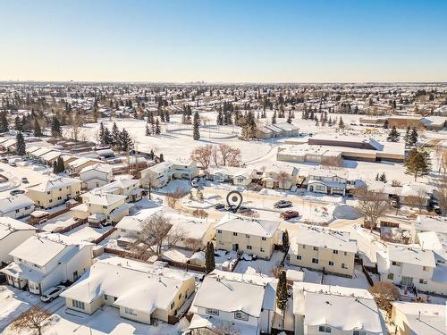 10319 172 Avenue Nw, Edmonton, AB - Outdoor With View