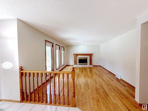 328 Burton Road Nw, Edmonton, AB - Indoor Photo Showing Other Room With Fireplace