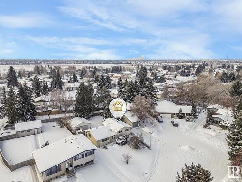 141 Homestead Crescent, Edmonton, AB - Outdoor With View