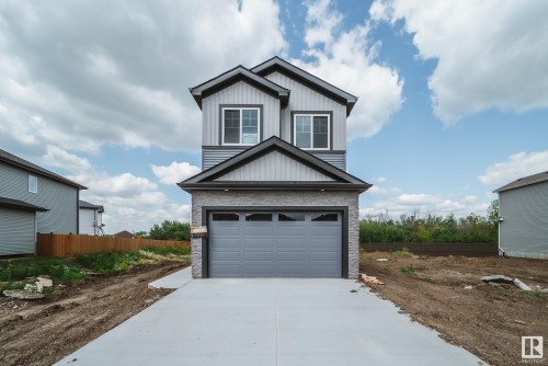 8824 183 Avenue, Edmonton, AB - Outdoor