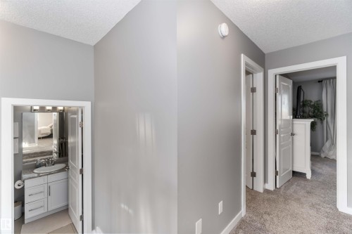 8306 180A Avenue, Edmonton, AB - Indoor Photo Showing Other Room