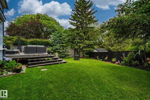 122 Village Downs, Sherwood Park, AB - Outdoor