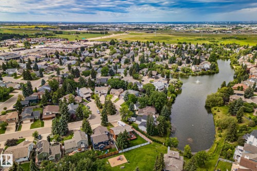 122 Village Downs, Sherwood Park, AB - Outdoor With View