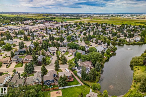 122 Village Downs, Sherwood Park, AB - Outdoor With Body Of Water With View