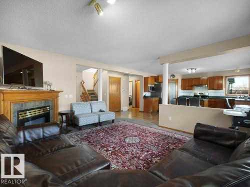 5320 156 Avenue, Edmonton, AB - Indoor Photo Showing Living Room With Fireplace