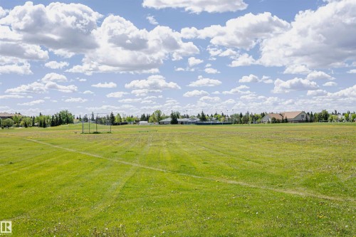 Expansive green field featuring a baseball backstop and distant residential structures - 1235 104 Street, Edmonton, AB - Outdoor With View