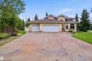 521 Estate Drive, Sherwood Park, AB 