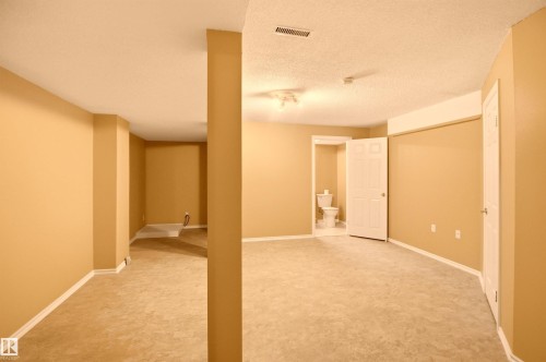 521 Estate Drive, Sherwood Park, AB 