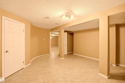 521 Estate Drive, Sherwood Park, AB 