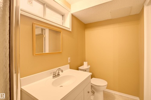 521 Estate Drive, Sherwood Park, AB 
