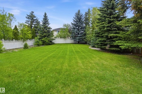 521 Estate Drive, Sherwood Park, AB 