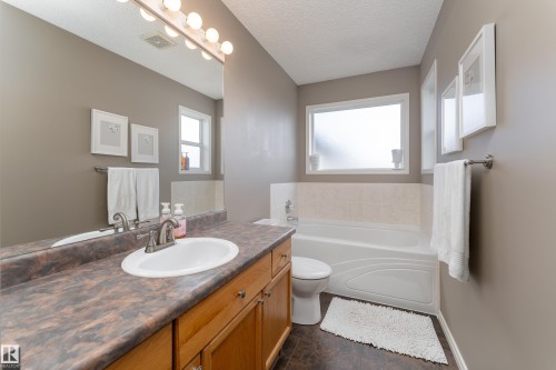 186 Foxboro Landing, Sherwood Park, AB 