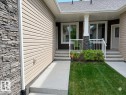 2 7115 Armour Link Link, Edmonton, AB 