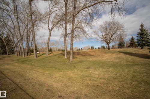 9 Great Oaks, Sherwood Park, AB 
