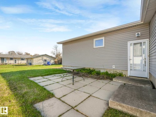 5916 148 Avenue Nw, Edmonton, AB - Outdoor
