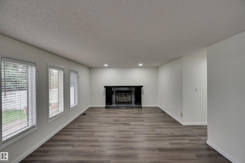 5507 179 Street Nw, Edmonton, AB - Indoor Photo Showing Living Room With Fireplace
