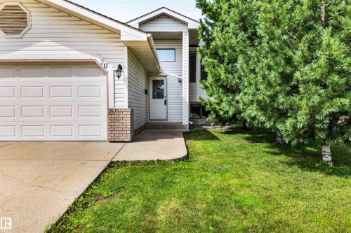 20 Highland Crescent, St. Albert, AB - Outdoor