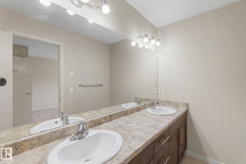 Dual sink vanity with laminate countertop and dark wood-finish cabinetry - 17304 73 Street Nw, Edmonton, AB - Indoor Photo Showing Bathroom