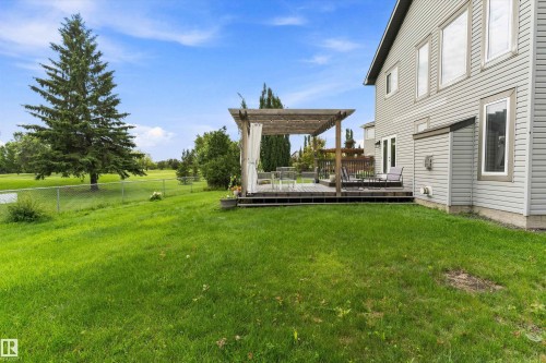 Expansive green lawn with a chain-link fence - 20845 92A Avenue Nw, Edmonton, AB - Outdoor