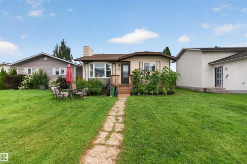9328 175 Avenue Nw, Edmonton, AB - Outdoor