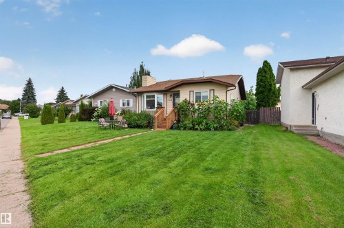 9328 175 Avenue Nw, Edmonton, AB - Outdoor